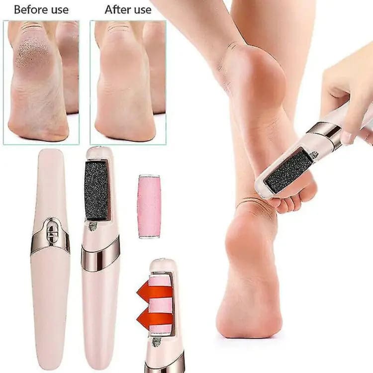Pro Electric Foot File – USB Rechargeable Callus & Dry Skin Remover