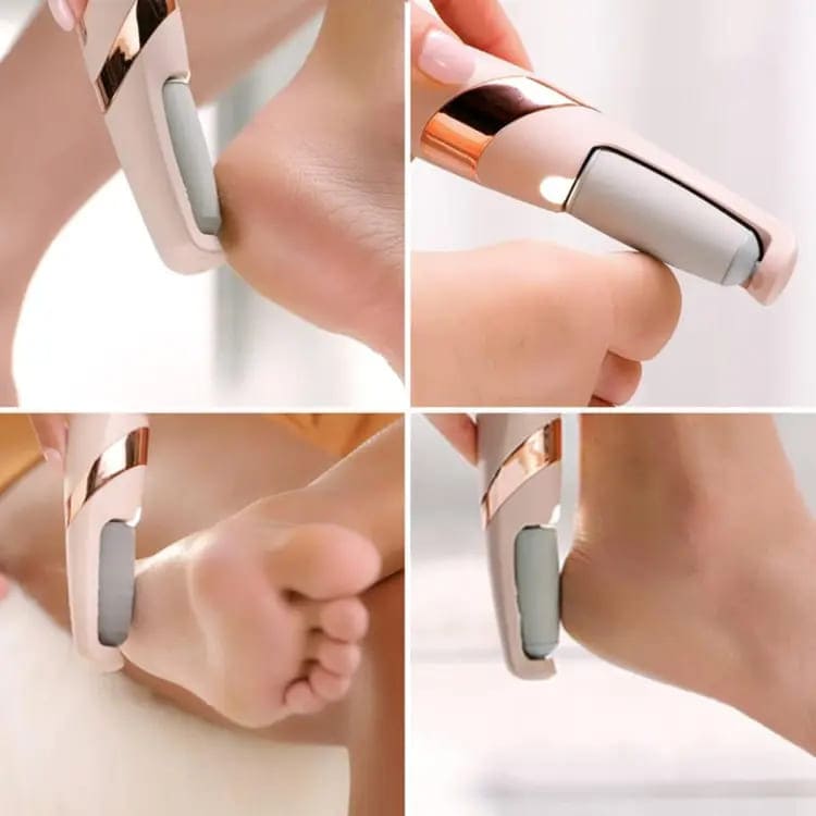 Pro Electric Foot File – USB Rechargeable Callus & Dry Skin Remover