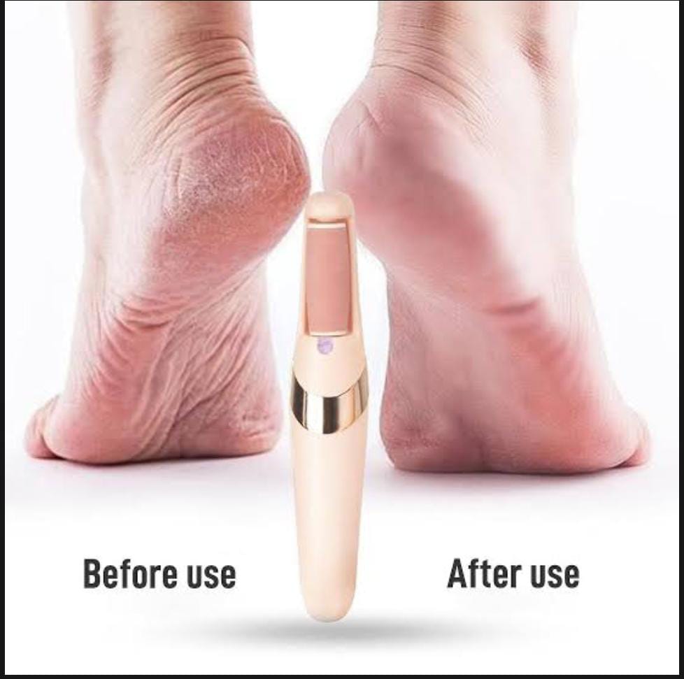 Pro Electric Foot File – USB Rechargeable Callus & Dry Skin Remover